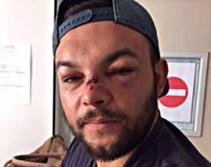 remi zuppel blessure - blessure