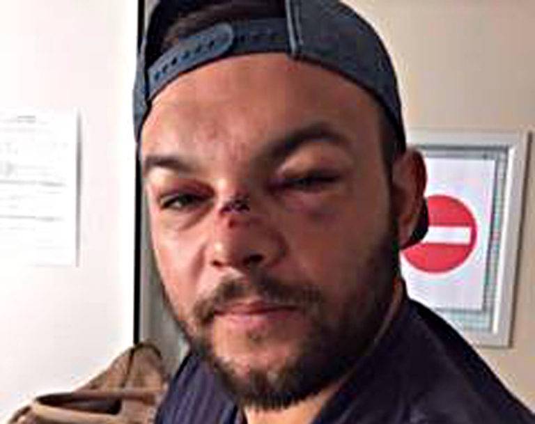 remi zuppel blessure - Tarascon