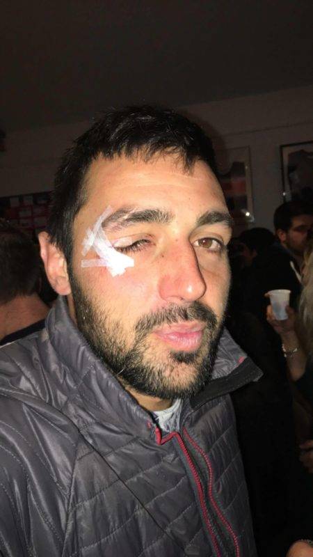 Kevin boyer capitaine de l’UcF XV duel aérien deux captiaines cabossés