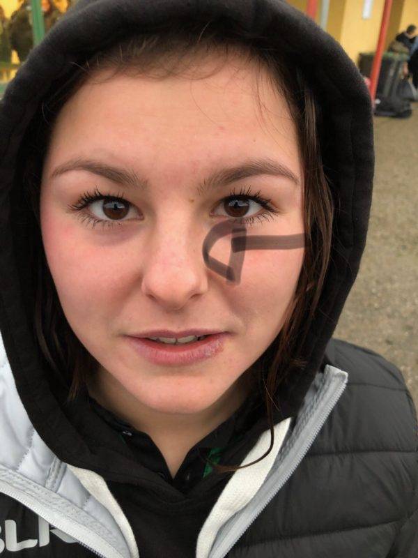 Quand t’y mets trop le nez ! emma detroit montauban