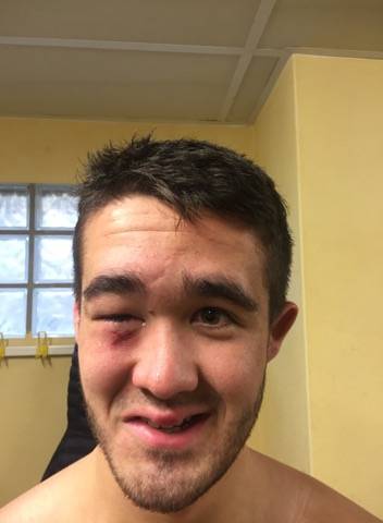 Kevin fit brunerie pillier de la réserve de saint sulp