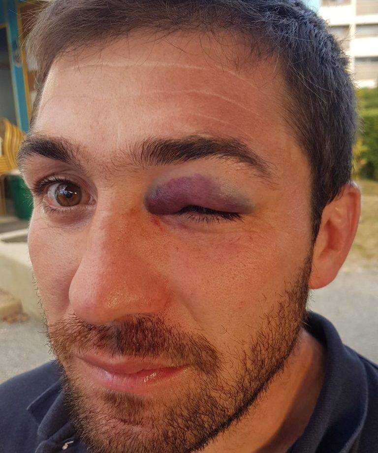 RCHQ Rugby club de haut Quercy Vayrac