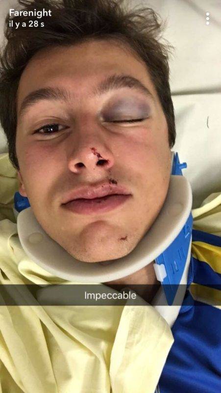 Thomas joueur junior a l’entente sud Aveyron qui se débrouille pour se déformer la tête à l’échauffement avant le match.