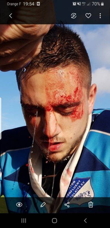 Un nicolaïte qui aura fait tout le match malgré sa bessure à la 24ème