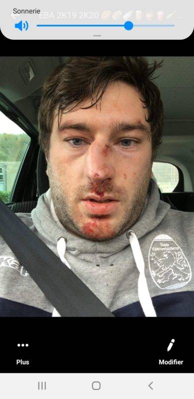 Un souvenir d un placage destructeur et un genou en pleine poire pour djé de villecomtal qui a toujours joué derrière et est passé 3 ieme ligne pour plaquer plus voilà le travail
