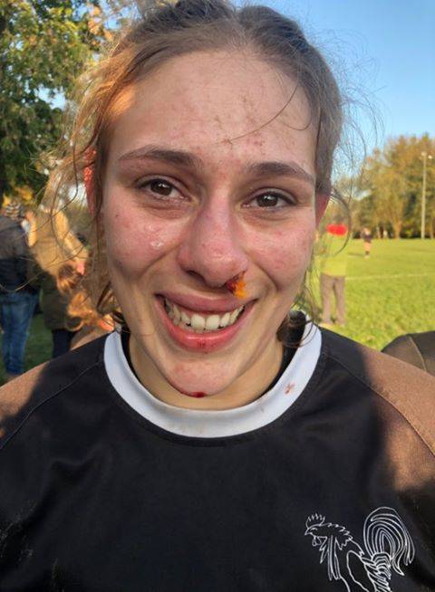 voici jozefien, alias Jojo, troisième ligne internationale belge qui a laissé son nez dans la boîte à gants lors de la 6ieme journée D1 belge avec son équipe du coq mosan