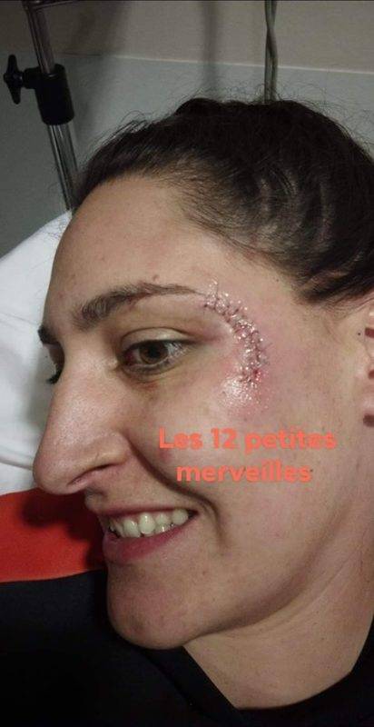 Fanny et Stéphanie MONTASTRUC (1)