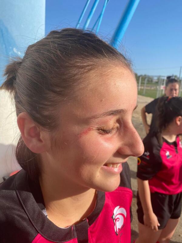 hannah centre du ras rugby quercy féminin premier match et petit coup de crampon contre montauban