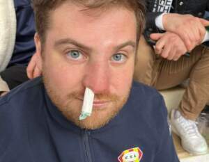 charles capitaine de la réserve du Cercle Sportif Ledonnien féd 2 contre ST Claude a pris un cup dans le nez pour stopper le saignement un bon tampon merci Yohann