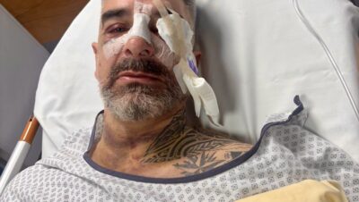 Rugby loisir Hérault : Eric, 51 ans, gravement touché suite à un violent coup de poing