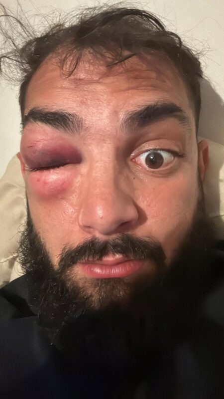 Halloween 2026 : les images les plus terrifiantes du rugby amateur