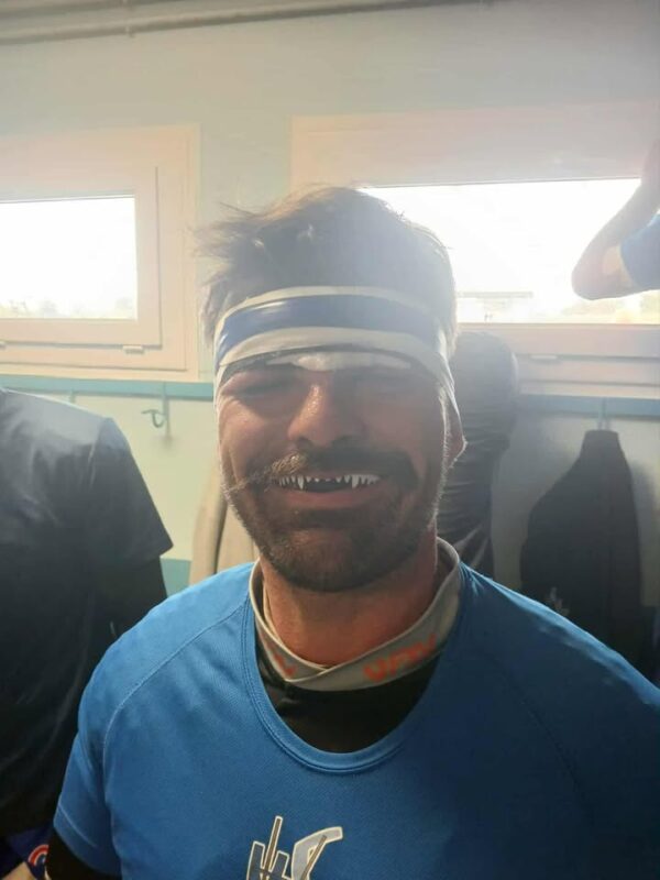 Halloween 2026 : les images les plus terrifiantes du rugby amateur